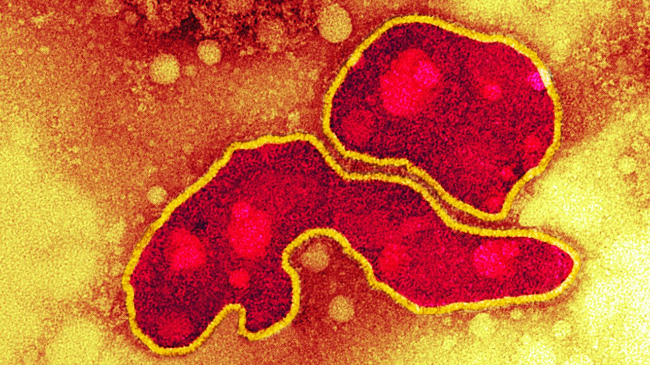 Avian influenza virus, type A strain H5N1, coloured transmission electron micrograph